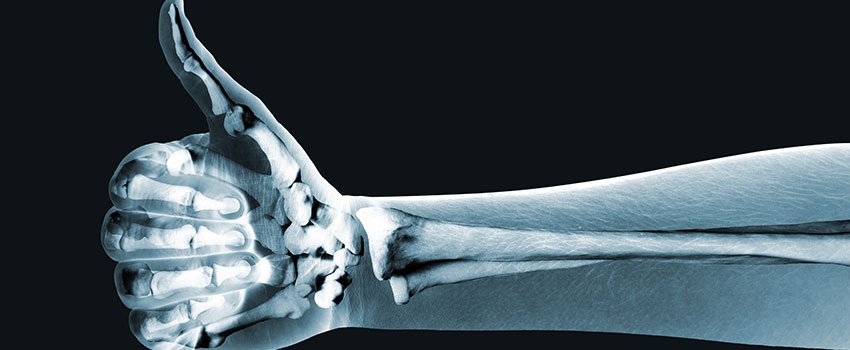 How to Tell if You Need an X-ray