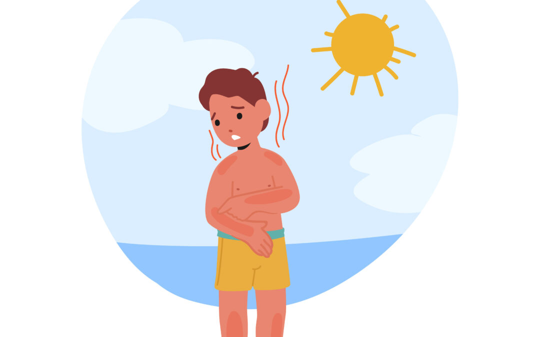 How to Tell If I Have Sun Poisoning?