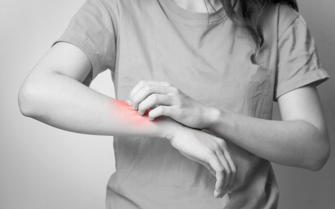 Should I Go to Urgent Care for Poison Ivy?